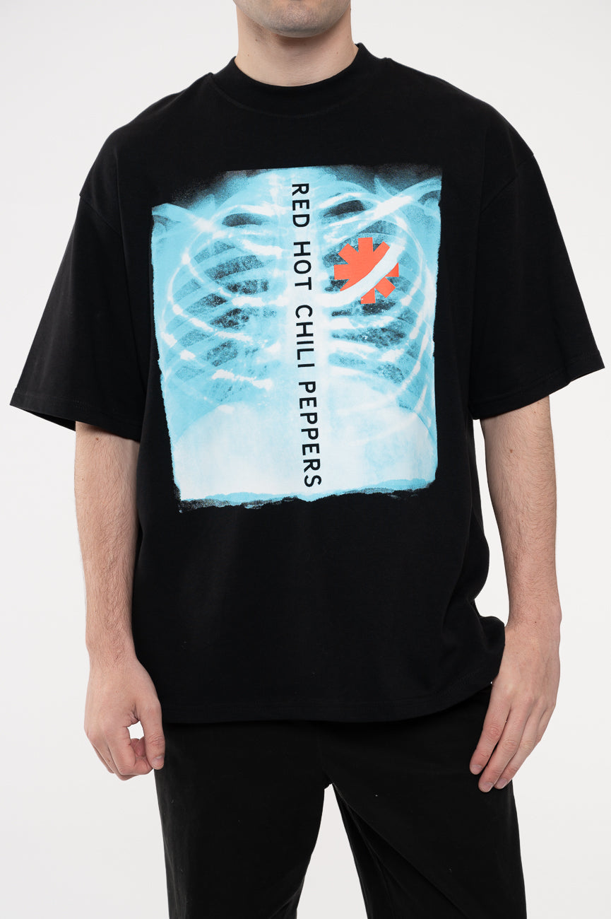 Red Hot Chili Peppers X Ray Limited Edition 999 Only product image 3